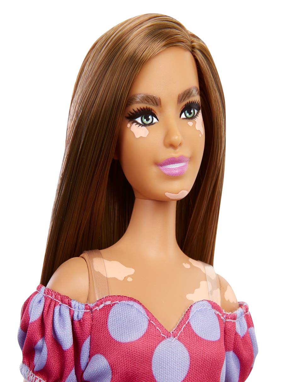 Muñeca Fashionista Vitiligo con Vestido de Lunares 2